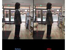 ストレチックス 近江八幡店/BeforeAfter
