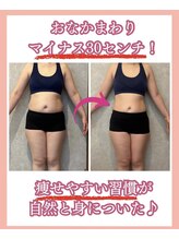 エミィシア(Emisia)/