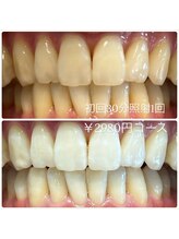 ホワイトニングルーム 横浜店(Whitening Room)/セルフホワイトニング/横浜
