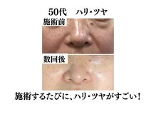 わ心美/ビフォーアフター