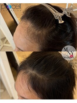 ラシュシュ(La chou chou)の写真/【育毛促進/頭皮改善専門】知識豊富なスタッフが丁寧にサポートいたします！頭皮のエイジングケアにも◎