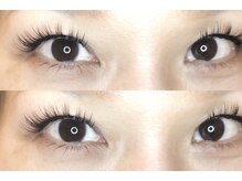 まつげエクステ専門サロン アイラ 綾瀬店(EYELA)/〔13〕エクステ装着イメージ
