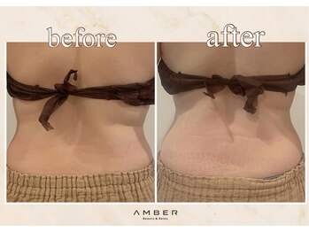 アンバー 恵比寿(AMBER)/運動では落ちにくい腰肉にも