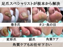 巻き爪補正店 岐阜店