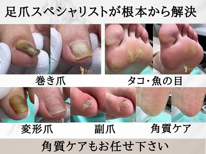 巻き爪補正店 岐阜店の写真