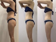 ビラ 銀座店(BILA)/キャビラジ