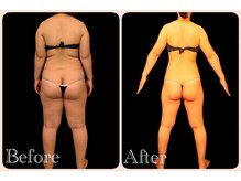 トータルビューティサロン クイーン(Queen)/エンダモロジー＆電磁パルス