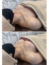 ロココ 天神店(Rococo)/バストアップ◇育乳症例◇