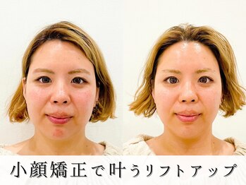 ジョンミー(JONMEE)