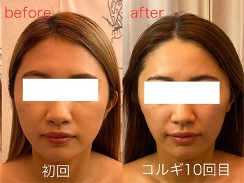 ビーキュート 神戸元町店(BE-CUTE)/コルギ10回目