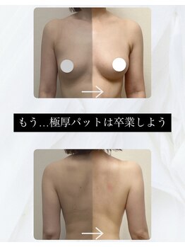 セイ(SEI)/バストアップビフォーアフター