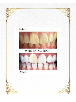 ホワイトニングショップ 葵区静岡駅店/ホワイトニング店ホワイトニング