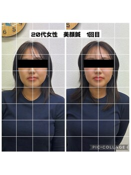 医心接骨院/フェイスラインがすっきり