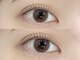 エルブリンク(elblink)の写真