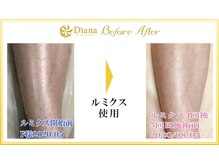 ディアーナ(Diana)/ Before/After