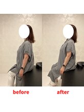 ナオル整体 福岡香椎院(NAORU整体)/60代女性施術事例【巻肩改善】