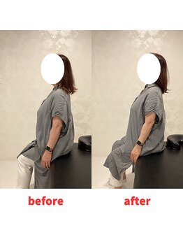 ナオル整体 福岡香椎院(NAORU整体)/60代女性施術事例【巻肩改善】