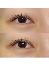 ヒールムーン(heal moon)/フラットラッシュ80～100