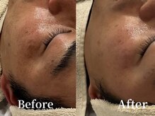 ザ パールズ(The Pearls)/ごわつき、くすみ、しわの改善に