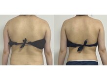 プリマルーチェ/プレミアム上半身プログラム