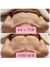 シェリーココ(cherie CoCo)/1年間で4カップUP