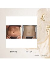 クーラ テュセ(Coeur la Tusais)/痩身ぽっこりお腹に