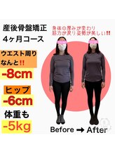 リノア(Linoa)/産後ママさんビフォーアフター