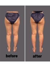 アリアグロウ(Aria Glow.)/浮腫みスッキリ！