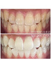 ホワイトニングルーム 横浜店(Whitening Room)/セルフホワイトニング/横浜