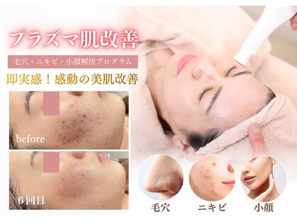ハナ チュチュ(Hana chuchu)の写真