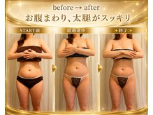 ポノ(pono)/beforeafter