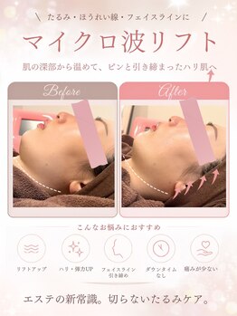 ウナ デ リンゴル 恵比寿店(UNA de Ringol)の写真/【イベントや大事な予定の前の駆け込み寺★】最新マイクロ波リフト最大出力保証★しっかり全顔照射