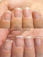 マリーロール 梅田店(Marie Laure)/自爪育成/深爪矯正/ネイルケア