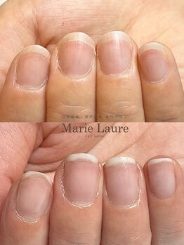 マリーロール 梅田店(Marie Laure)/自爪育成/深爪矯正/ネイルケア