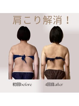 オルオル(.olu olu)/肩こり解消!