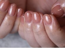 サロンレム(salon Rem.)/【パラジェル深爪矯正】