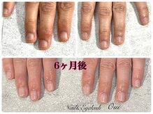 ウイ(Oui)/深爪育成