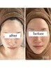 陶器のようなツルンとした美肌へ【小顔効果/美白効果】どんな肌質の方にも◎
