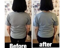 トトノウ 自由が丘店(totonou)/Before after (5)