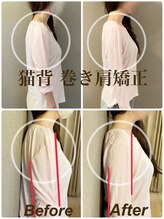 ティーエスエル とがし整体ラボ(TSL とがし整体 Labo)/姿勢矯正・猫背 巻き肩/美容整体