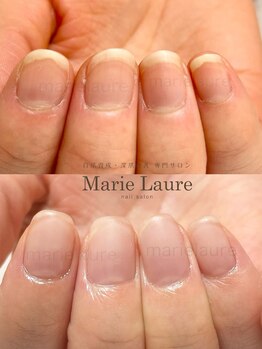 マリーロール 天王寺店(Marie Laure)/深爪矯正/自爪育成/ネイルケア/