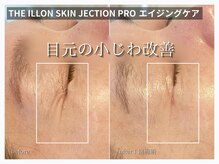 ラ ドゥーサ(La Dusa)/エイジングケア小じわ改善