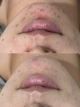 ビビィ(Bibiy)/クリスティーナ/ビオフィート