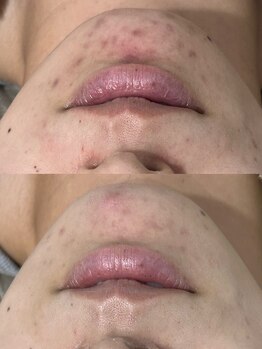 ビビィ(Bibiy)/クリスティーナ/ビオフィート