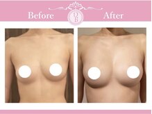 デミーナ(Demyna)の雰囲気（育ちづらい原因を徹底解明☆育乳のプロがバストアップを実現！）