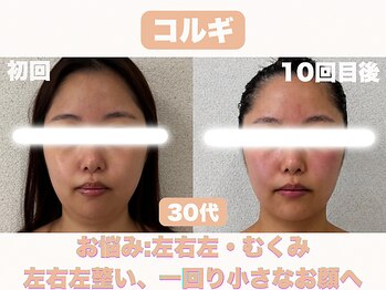 ナーナモエ(na-namoe)/お顔が一回り小さく小顔へ