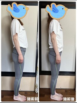 ユキケアサロン(YUKI care SALON)の写真/【フェムケア矯正】女性特有のお悩みに！洋服を着たまま骨盤周りから整える全身ケア