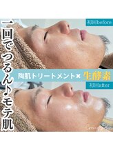 クレヴィー(Creviy)/陶肌トリートメント1回目