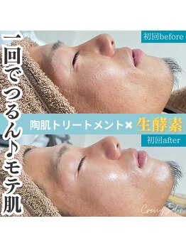 クレヴィー(Creviy)/陶肌トリートメント1回目