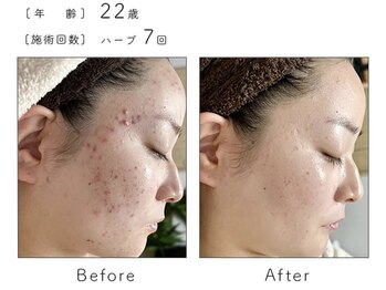 サロン バイオビオ(SALON BioBio)/